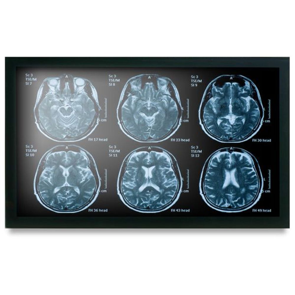 MEDDP-622HPN-A1-1010 - Onyx MEDDP-622HPN 21.5" Medical Touch Display