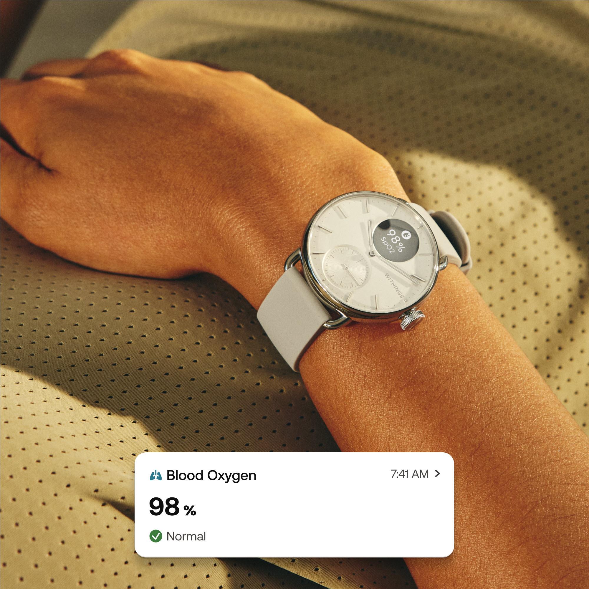 Withings ScanWatch 2 (White) [38mm]